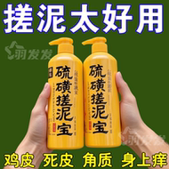 硫磺搓泥宝除螨去角质止痒祛痘