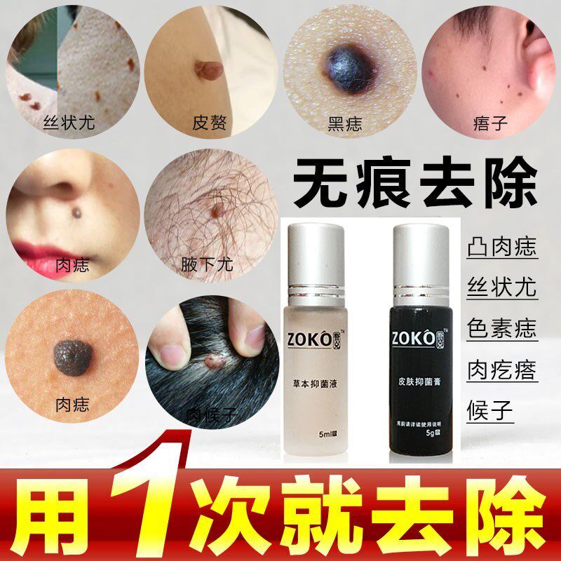 消忧疣瘊平去皮肤赘生物小肉粒疙瘩外用去瘊子疣瘊净肉痣去捂子猴