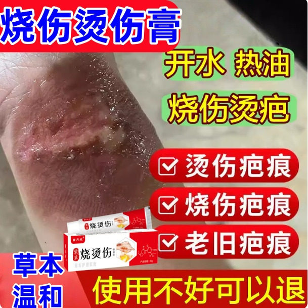 紫草烧伤烫伤膏成人淡化去除疤痕膏起泡黑印修复油开水烫伤修护膏
