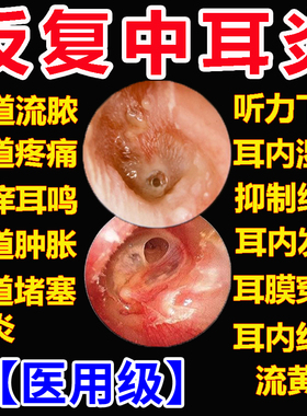 氧氟沙星滴耳液滴KASHINE