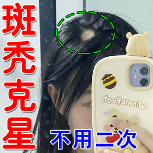 天麻何首乌片国华何首乌片治疗脱发药物养血补肾非同仁堂胶囊