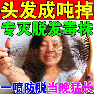 斑秃米诺地尔町生发液2%女性斯必申脱发育发生发液搽剂非凝胶