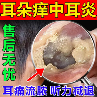 滴耳宝碳酸氢钠滴耳液抑菌液耳屎软化婴儿童耵聍水液剂耳垢宝宝