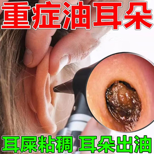 青霉素v口服药青帝片V钾片