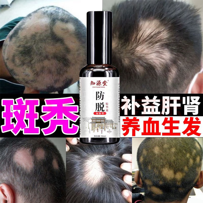 复方胱氨酸片氨基酸复合维生素片头发根营养