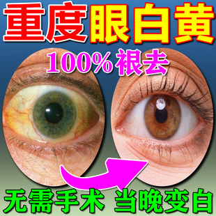 急性闭角型青光眼原发性开角型青光眼降眼压