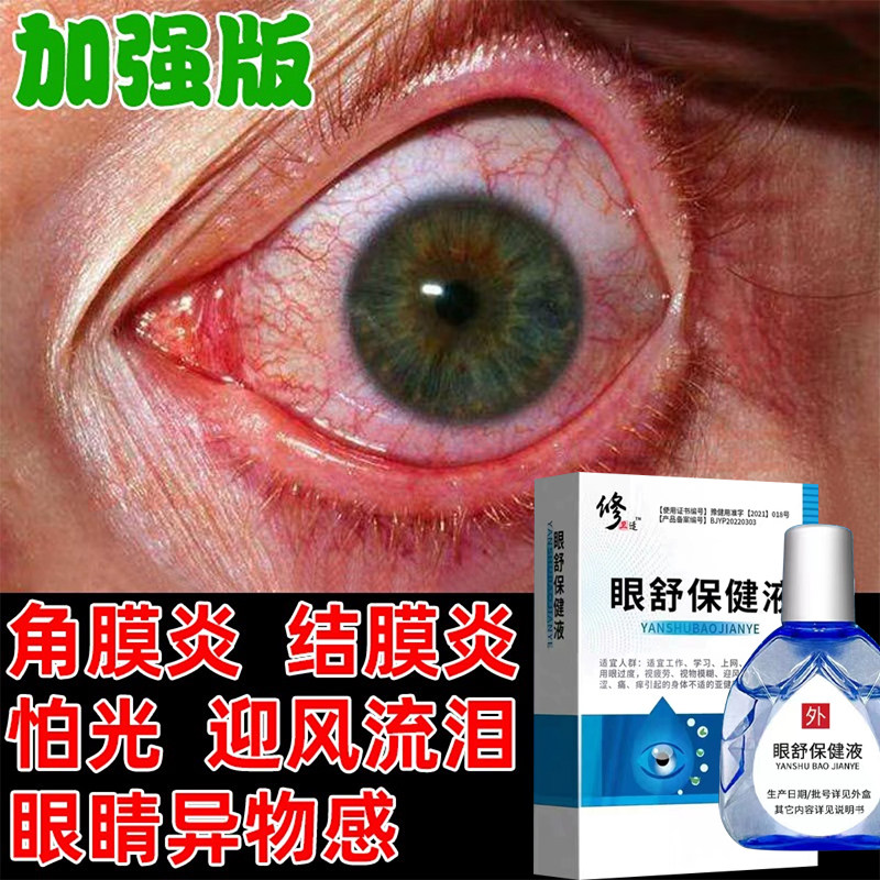 熊胆明目滴眼液疲劳干涩复方硫酸软骨素滴眼液眼干燥症眼药水
