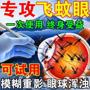 眼睛流泪异物感流行性角结膜炎角膜炎