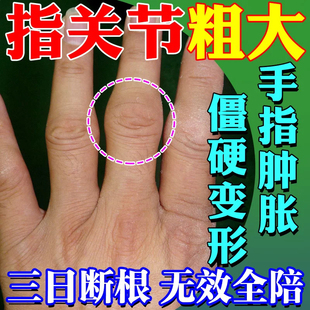 杏林泰消炎镇痛膏缓解风湿痛肩痛肌肉疼痛神经痛祛风散寒除湿止痛