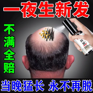 复方斯亚旦发酊生中药生发治疗防脱发斑秃密发增发脂溢性脱发