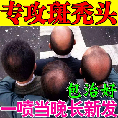 胱氨酸生发蔚达vitahealth防脱养发内调头发营养胱氨酸