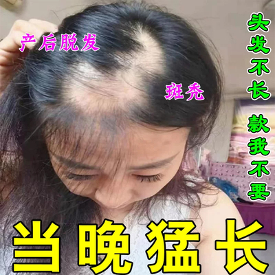 复方斯亚旦生发油GrowGorgeous强效增发精华防脱护发