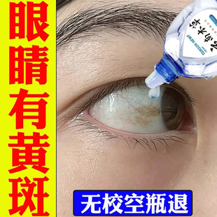 色甘酸钠滴眼色甘滴眼液