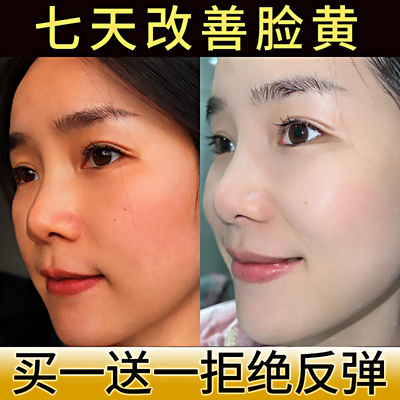 美白提亮去黄气改善暗沉肤色去暗黄褪黄祛斑脸部皮肤黑男女精华液
