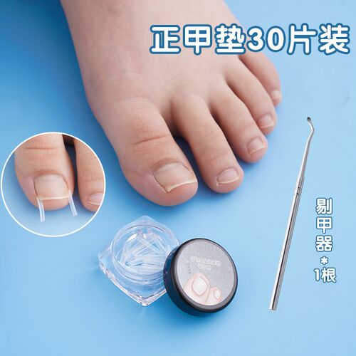 甲沟炎矫正器正甲贴指甲贴片嵌甲脚趾甲往肉里长纠正隔离填充垫片