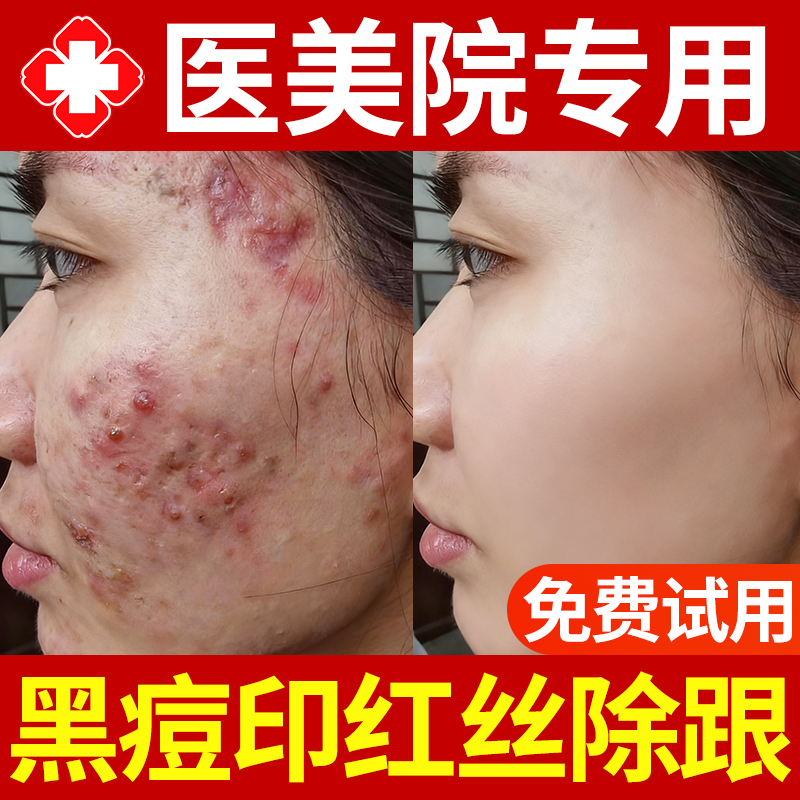 【美容院专属】黑痘印褪红精华
