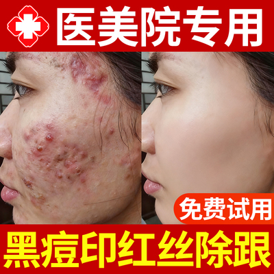 【美容院专属】黑痘印褪红精华