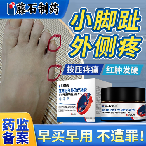 【医用级】小脚趾外侧疼