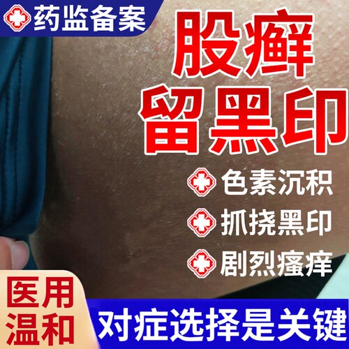 股藓去黑去除大腿内侧黑印专用膏