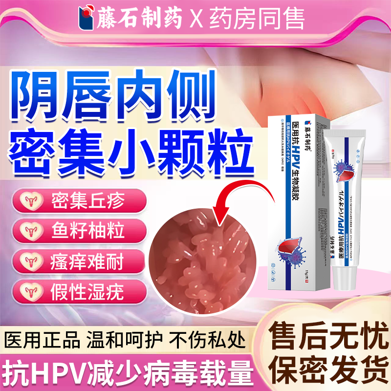 女性私处去假性尖锐湿疣专用外阴瘙痒阴道口长小疙瘩药房同款膏BS