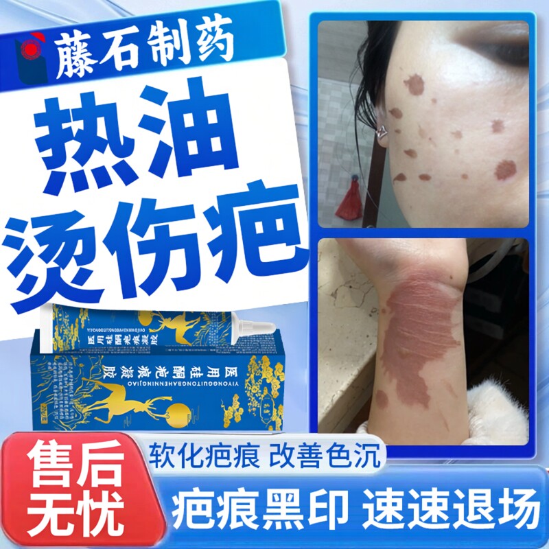 油溅被热油烫伤去疤膏疤痕修复去黑印淡化黑色素沉淀医用除疤膏BS