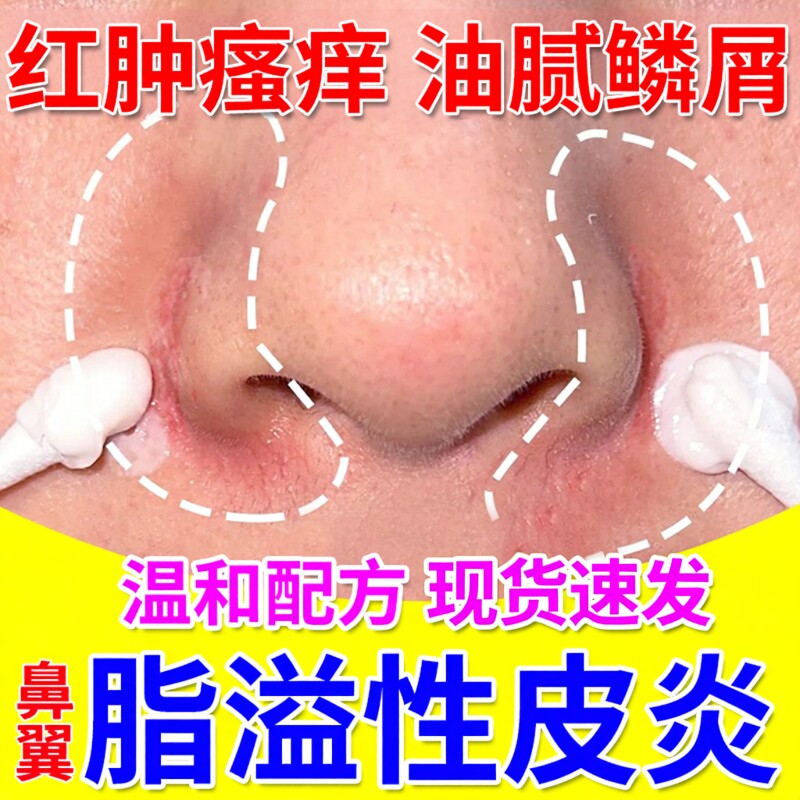 鼻翼脂溢性皮炎面部面霜软膏鼻子两侧发红脸上皮肤干燥起皮脱皮JW