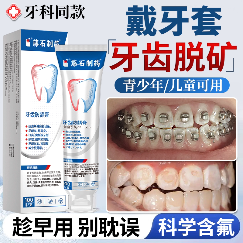 青少年儿童牙齿脱矿可搭正畸牙膏矫正含氟防龋再矿化专用护牙素JW