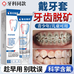 青少年儿童牙齿脱矿可搭正畸牙膏矫正含氟防龋再矿化专用护牙素JW