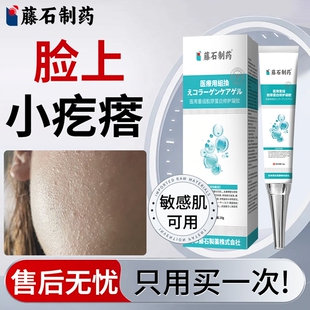 逆光疹屏障修复脸上起小疙瘩长痘痘脓包额头毛囊炎闭口药房款膏EM