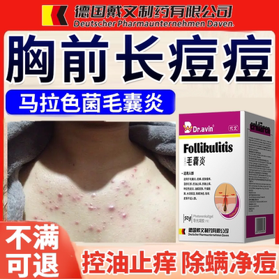 德国公司监制】前胸后背毛囊炎膏
