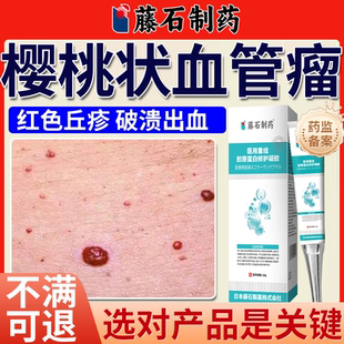 樱桃状血管瘤血管痣去除血痣毛细血管瘤皮肤点去红痣药房同款膏BS