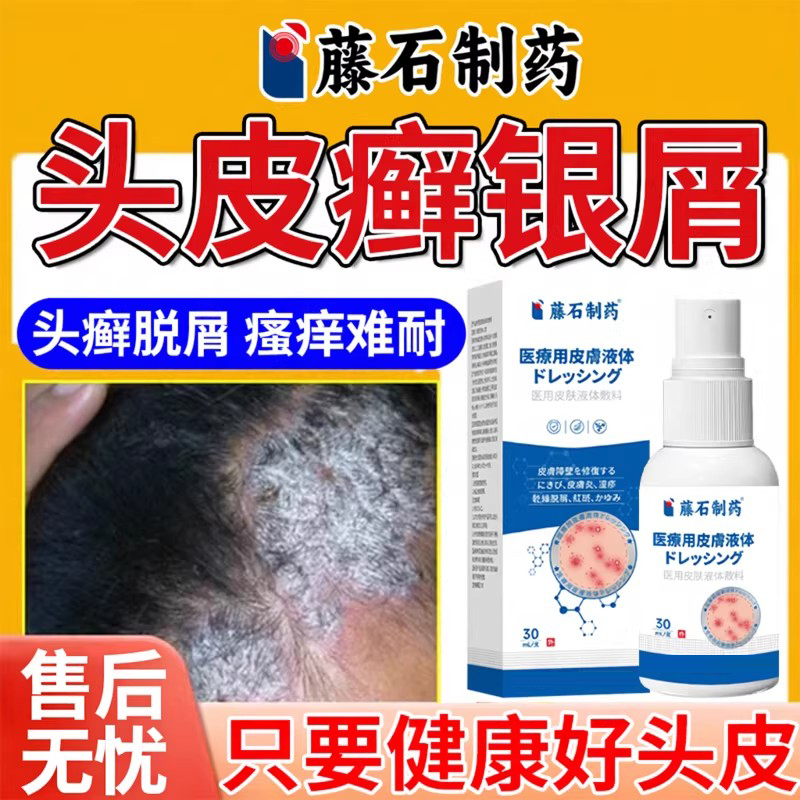 头皮真菌感染牛皮癣洗头膏银屑病专用去银血病和洗发水薬房款膏DZ