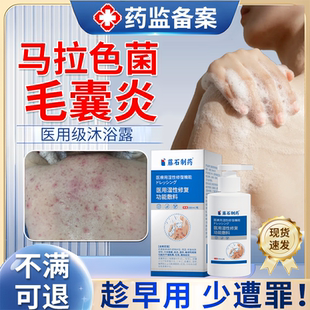 藤石制药背上长痘毛囊炎马拉色菌除螨祛痘痒前胸后背专用沐浴露JW