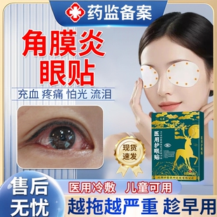 暴露性角膜炎病毒性结膜炎真菌可搭配眼药水滴眼液用眼贴护眼贴JW