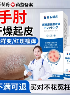 胳膊肘干燥起皮手肘关节癣真菌感染去除死皮皮肤干裂黑色素沉淀EM