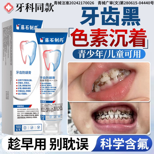 【牙科同款】牙黑斑牙菌斑去除膏