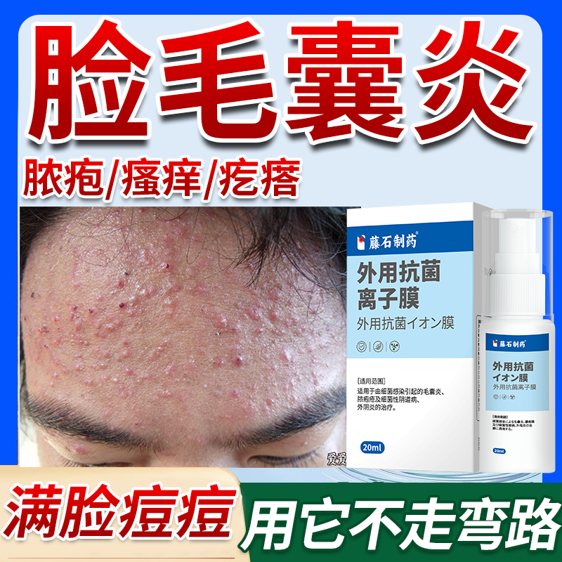 脸上痘痘毛囊炎藤石起小肉疙瘩马拉色菌下巴反复长脸部痤疮药膏OZ
