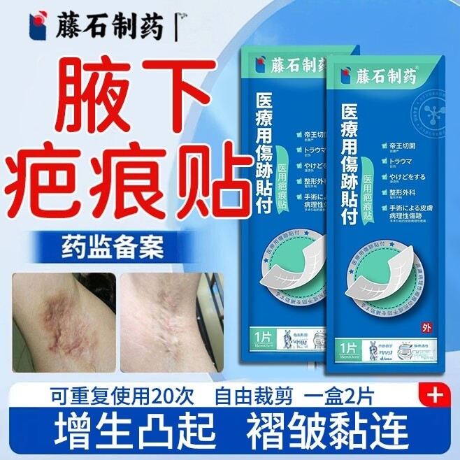 腋下疤痕贴狐臭手术隐形贴遮盖神器胳肢窝祛疤膏疤痕增生凸起JW