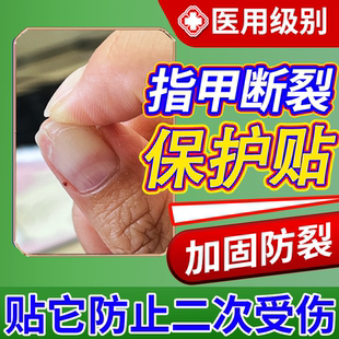 指甲劈了断裂劈裂手指甲盖受伤边缘裂口开裂护甲套保护贴医用级JW