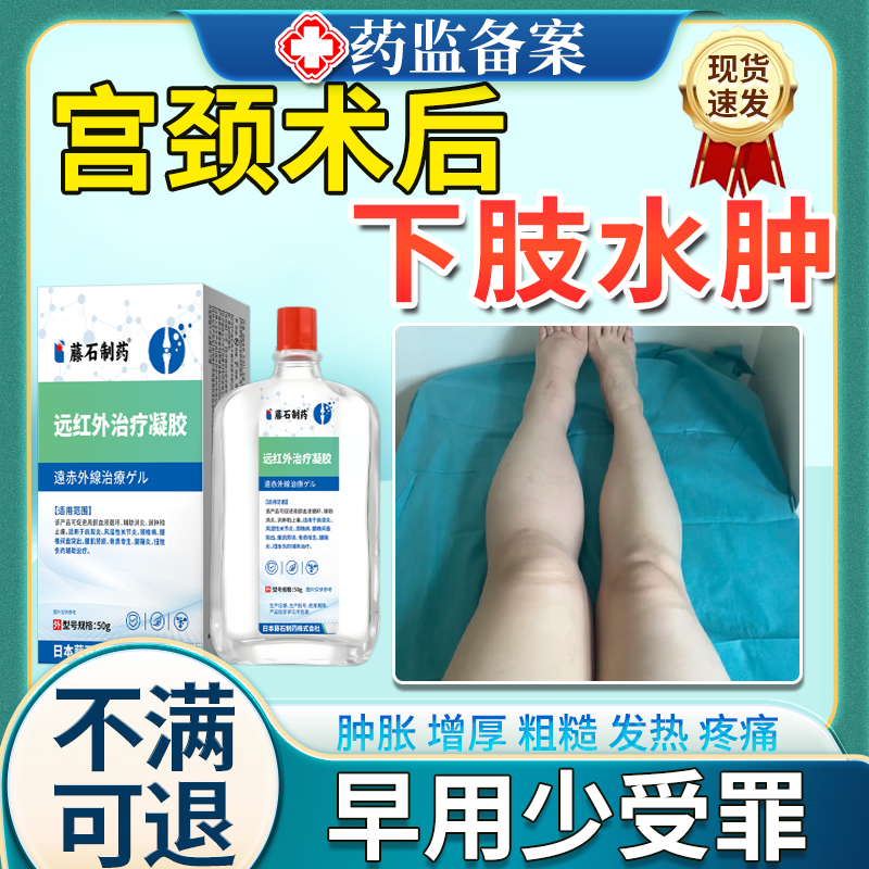 术后下肢淋巴水肿消肿专用凝胶