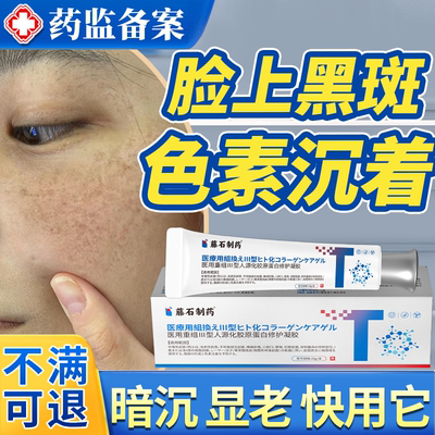 祛脸上黑斑色素沉着凝胶