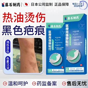 被油溅烫伤烧伤去疤膏疤痕修复除疤膏去黑印黑色素沉淀烧伤凝胶EM
