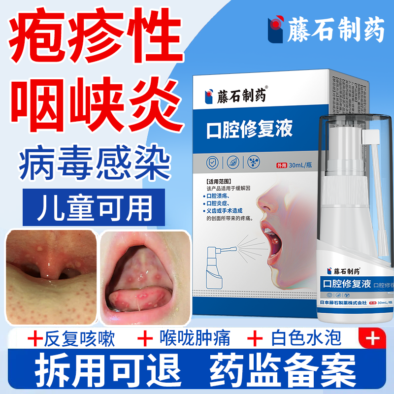 藤石制药疱疹性咽峡炎儿童喷雾剂口腔疱疹小儿喉咙疼痛咽喉肿痛EM