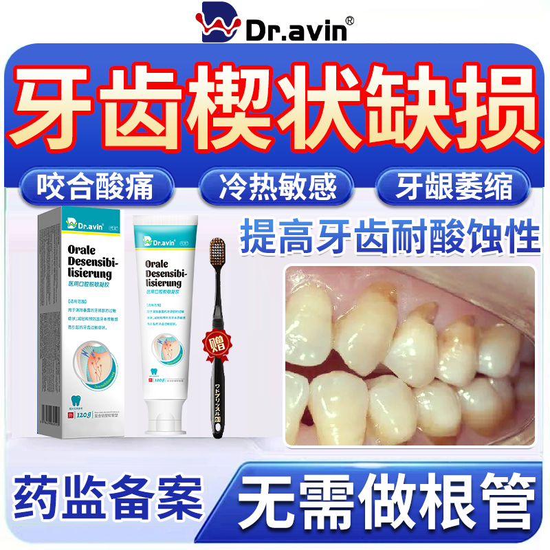 牙齿楔状缺损修补牙根外露牙齿敏感酸痛牙齿烂洞修复液凝胶牙膏EM