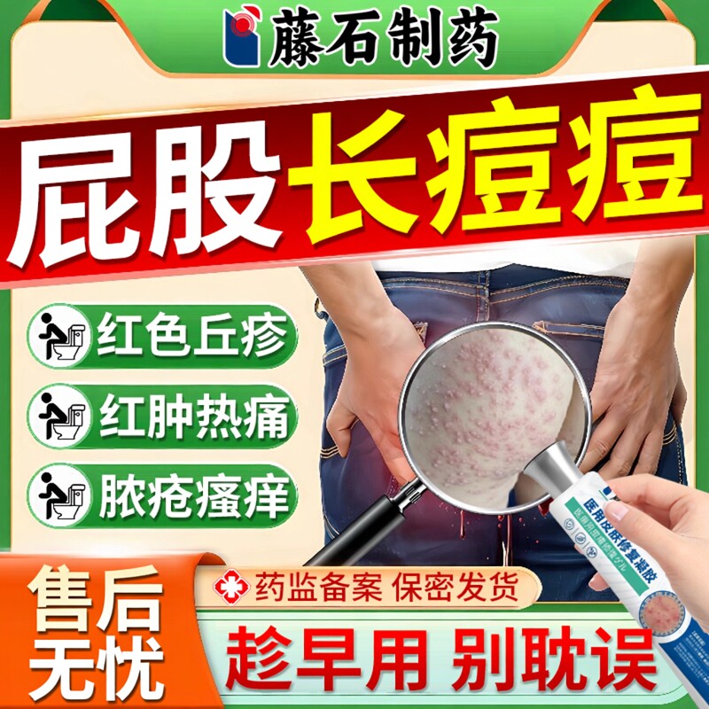 【医用级】屁股长红肿脓包痘凝胶图片