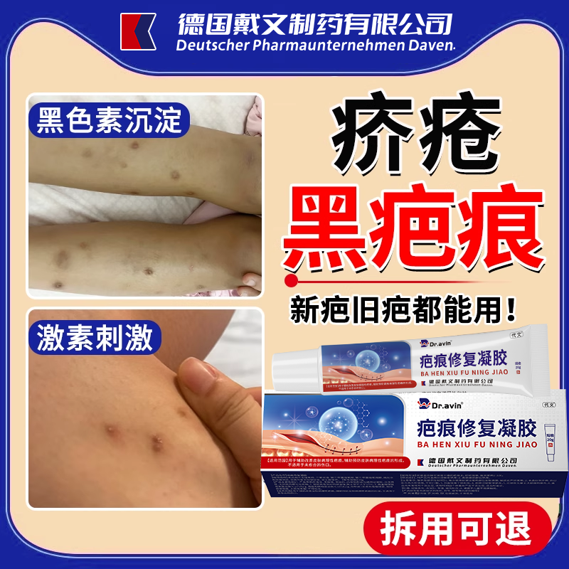 疥疮留的疤痕黑印色素沉着专用膏