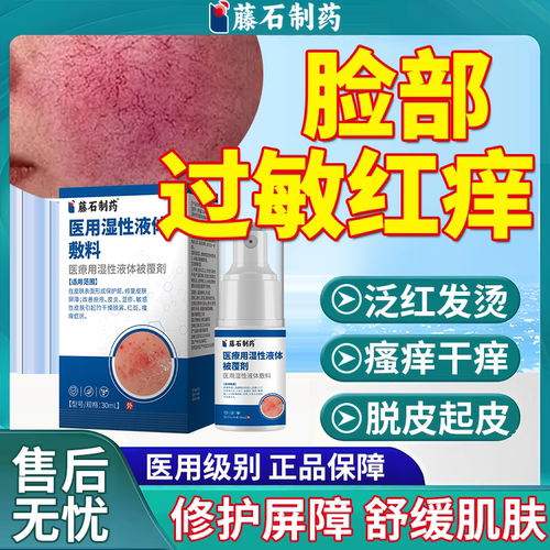 【医药级别】激素脸修复过敏红痒