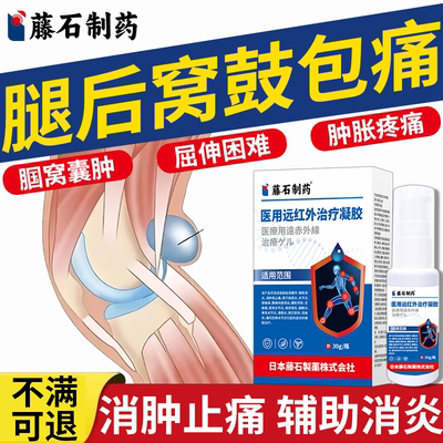 腘窝囊肿鼓包肿痛积液医用喷雾剂