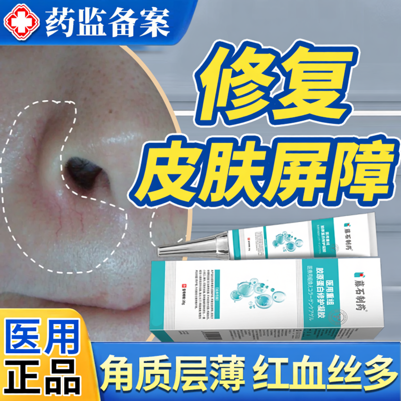 红血丝修去除角质层复祛鼻子两侧发红脱皮鼻翼两边泛红干燥起皮JW