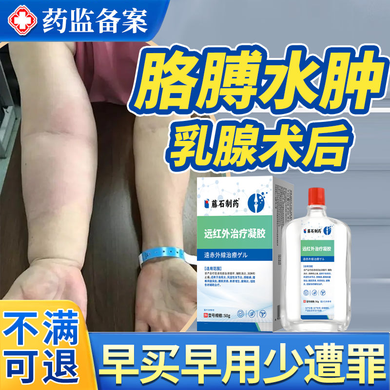 乳腺术后上肢淋巴水肿压力袖套绷带手套康复用品药房同款医用JW